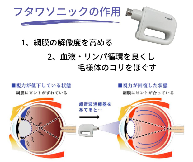 フタワソニックの作用　１、網膜の解像度を高める　２、血液・リンパ循環を良くし毛様体のコリをほぐす