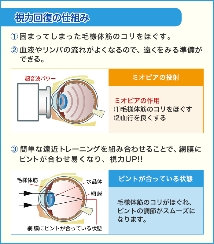 視力回復の仕組み